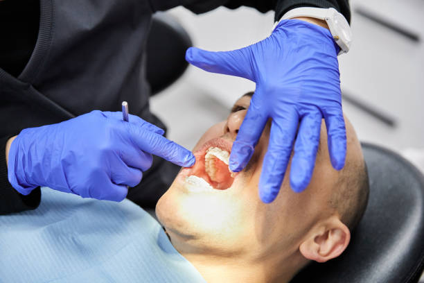 Best Emergency Wisdom Teeth Removal in Auburn, ME
